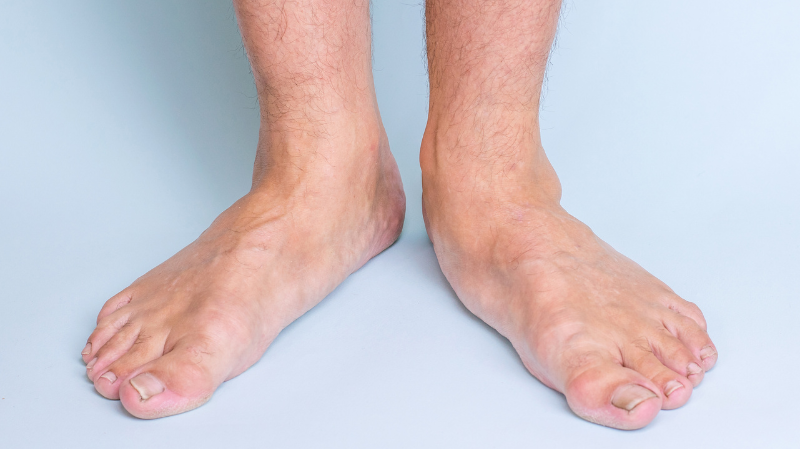 Common Foot Issues & How Barefoot Shoes Can Help