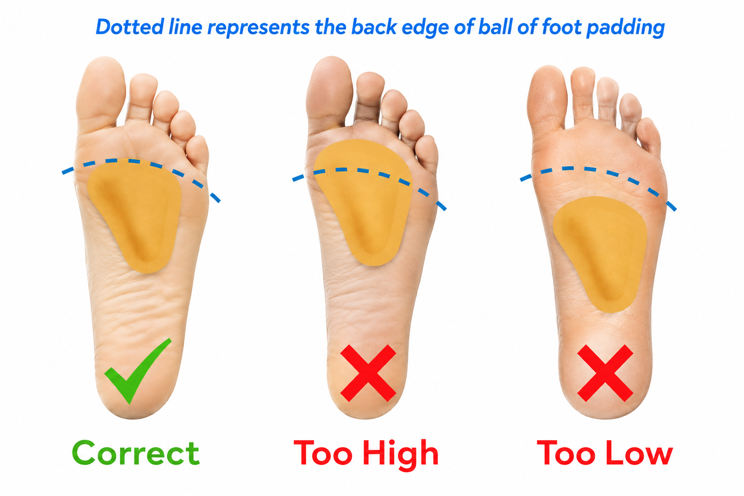 Pedag Metatarsal Pad