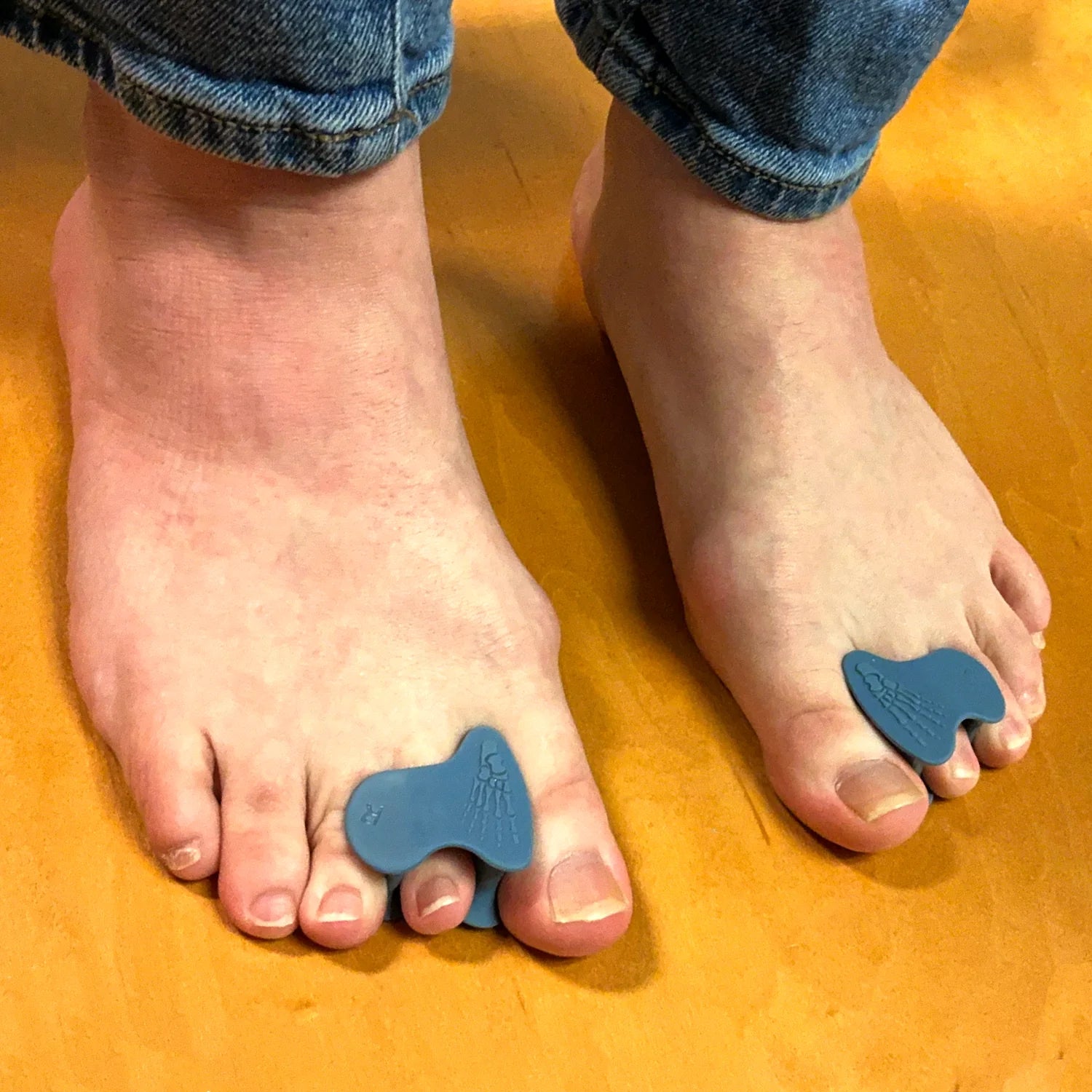 Correct Toes® - Stable Toe