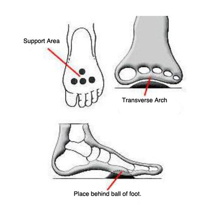 Pedag Metatarsal Pad - bprimal