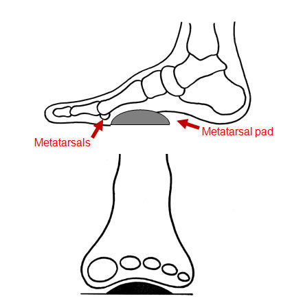 Pedag Metatarsal Pad - bprimal